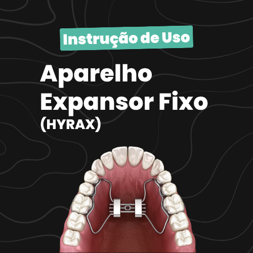 Aparelho Expansor Fixo (HYRAX)